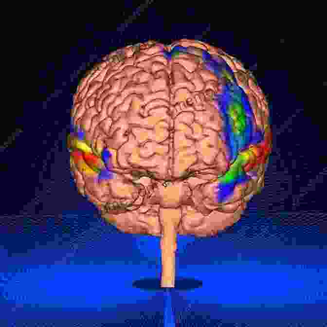 A Brain Scan Showing Abnormal Activity In The Auditory Cortex, Which May Be Associated With Verbal Hallucinations. Voices Of Reason Voices Of Insanity: Studies Of Verbal Hallucinations