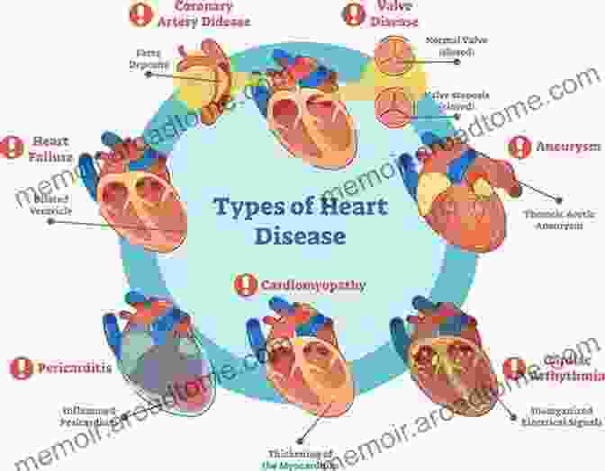 A Diagram Of The Different Types Of Vascular Disease. How To Reverse Aging:how To Be Smart Fit Strong And Potent:: Written By MD Expert On Vascular Disease Neuroscience And Nutrition