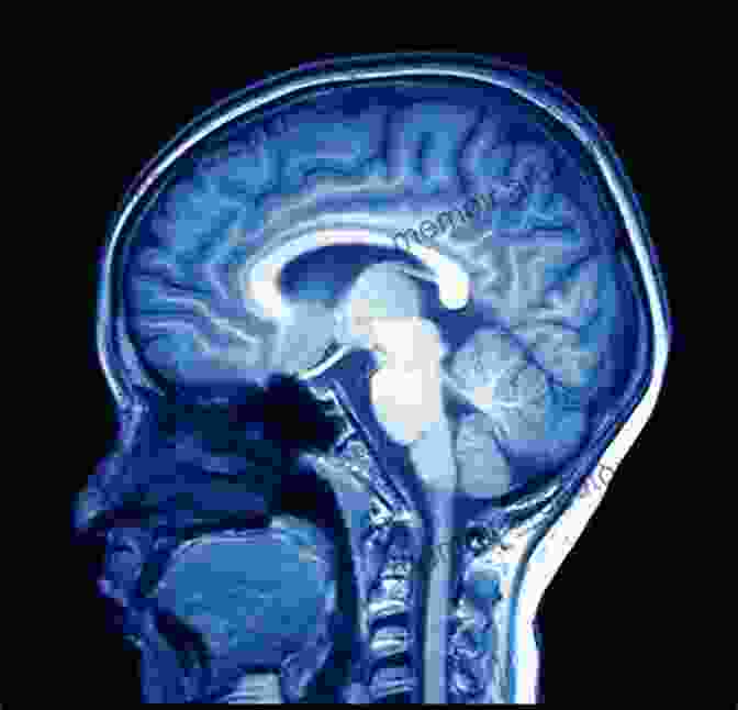 A Vivid Magnetic Resonance Imaging (MRI) Scan Of The Human Brain, Showcasing The Intricate Network Of Neural Connections. Research Methods For Cognitive Neuroscience