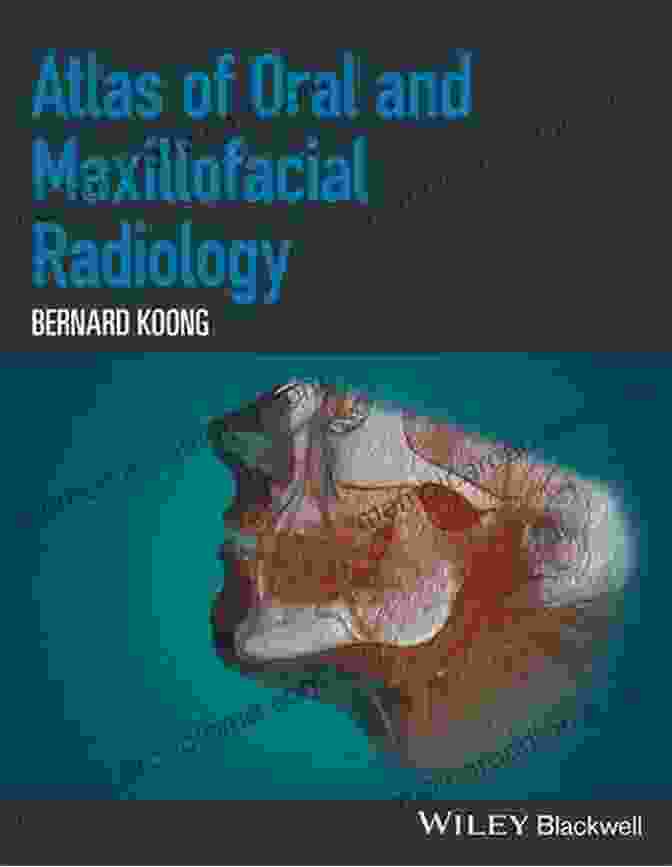 Atlas Of Oral And Maxillofacial Radiology Book Cover Atlas Of Oral And Maxillofacial Radiology