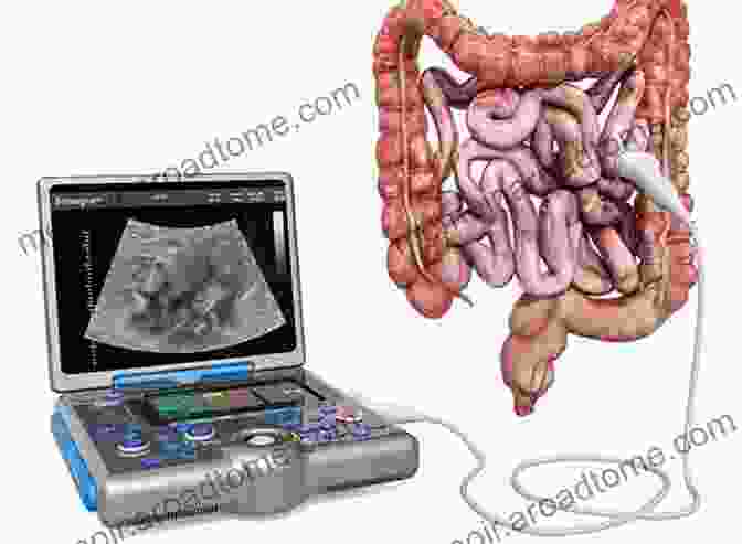 Longitudinal Endoscopic Ultrasound Image Of The GI Tract Basic Approach To Longitudinal Endoscopic Ultrasound A