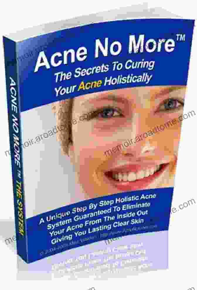 The Acne Cure For Life Book Cover With A Woman Smiling And Touching Her Clear, Glowing Skin The Acne Cure For Life: The Ultimate Skincare Guide Acne Treatment Diet And Scar Removal (Acne Treatment And Cure)