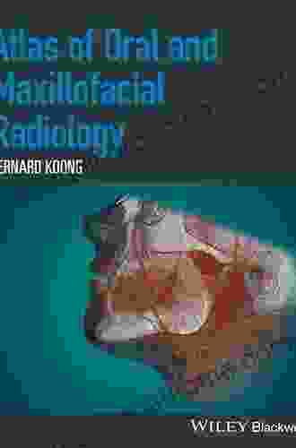 Atlas Of Oral And Maxillofacial Radiology