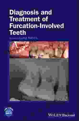 Diagnosis And Treatment Of Furcation Involved Teeth