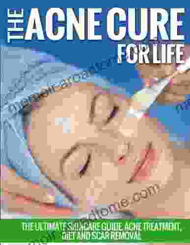 The Acne Cure For Life: The Ultimate Skincare Guide Acne Treatment Diet And Scar Removal (Acne Treatment And Cure)