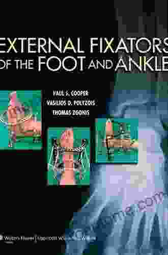 External Fixators Of The Foot And Ankle