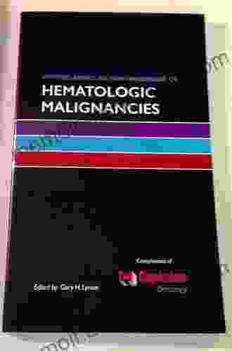 Oxford American Mini Handbook Of Hematologic Malignancies (Oxford American Mini Handbooks)