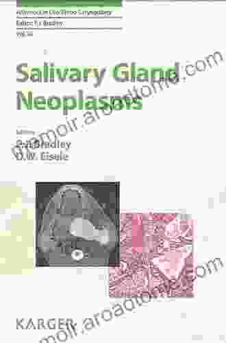 Salivary Gland Neoplasms (Advances in Oto Rhino Laryngology 78)