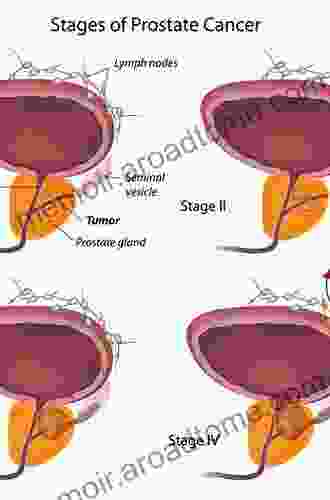 The Trial Of Stage IV Prostate Cancer: A Wife S Case For Faith Hope And Help